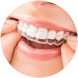 Invisalign and Illusion clear aligners on a smile