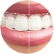 Smile designing: close-up of an even, bright smile